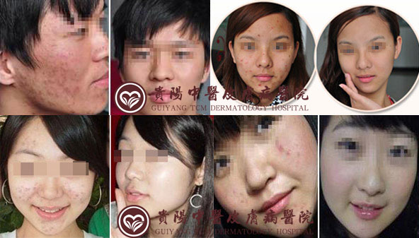 ��Ժ�����Ч��ͼ��ǰ��Աȣ�